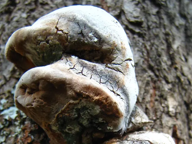 Ludwig's Angina: Typical Bacteria Implicated in Its Development