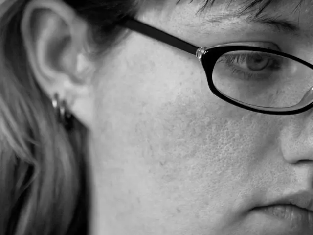 Eligibility and Process for LASIK Eye Surgery