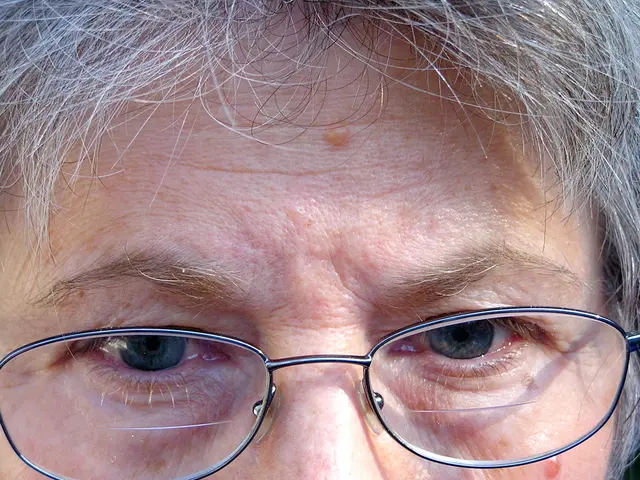 Eye Albinism: Signs, Causes, Identification, and Treatment Strategies